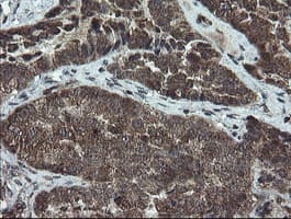 DOK7 Antibody (clone OTI1A9)
