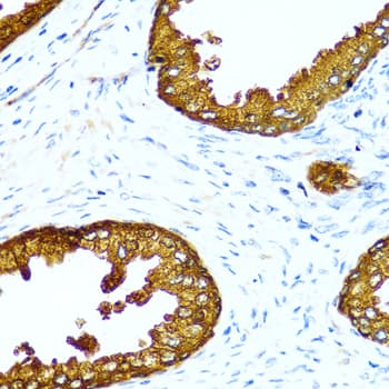Polyclonal Rabbit anti-Human ACPP / PAP Antibody (IHC, WB)