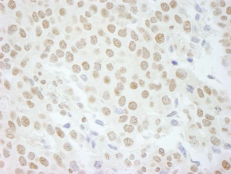 Polyclonal Rabbit anti-Human PLRG1 Antibody (aa464-514, IHC, IF)