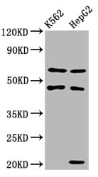 GATB / PET112 Antibody