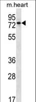 Polyclonal Rabbit anti-Human PARP2 Antibody (aa306-336, WB)