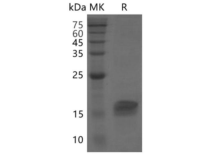 Coronavirus SARS-CoV-2 ORF8 Protein (Recombinant His, N-terminus)