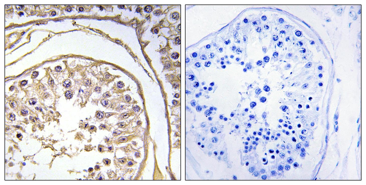 BAGE2 Antibody