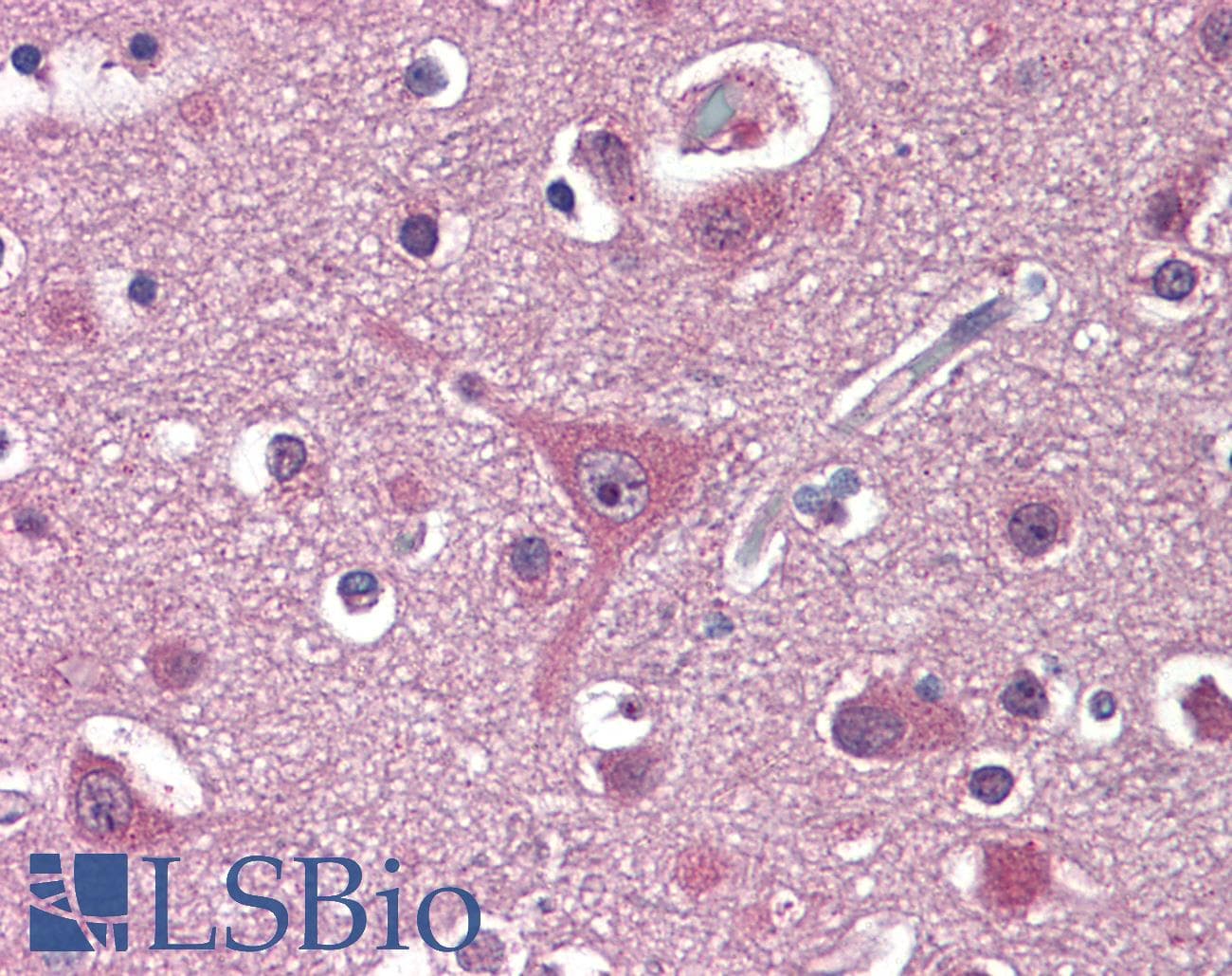 IHC-plus™ Monoclonal Mouse anti-Human PPAT Antibody (clone 3C6, IHC, WB)