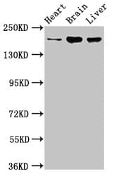 Polyclonal Rabbit anti-Human ARFGEF2 / BIG2 Antibody (IHC, IF, WB)