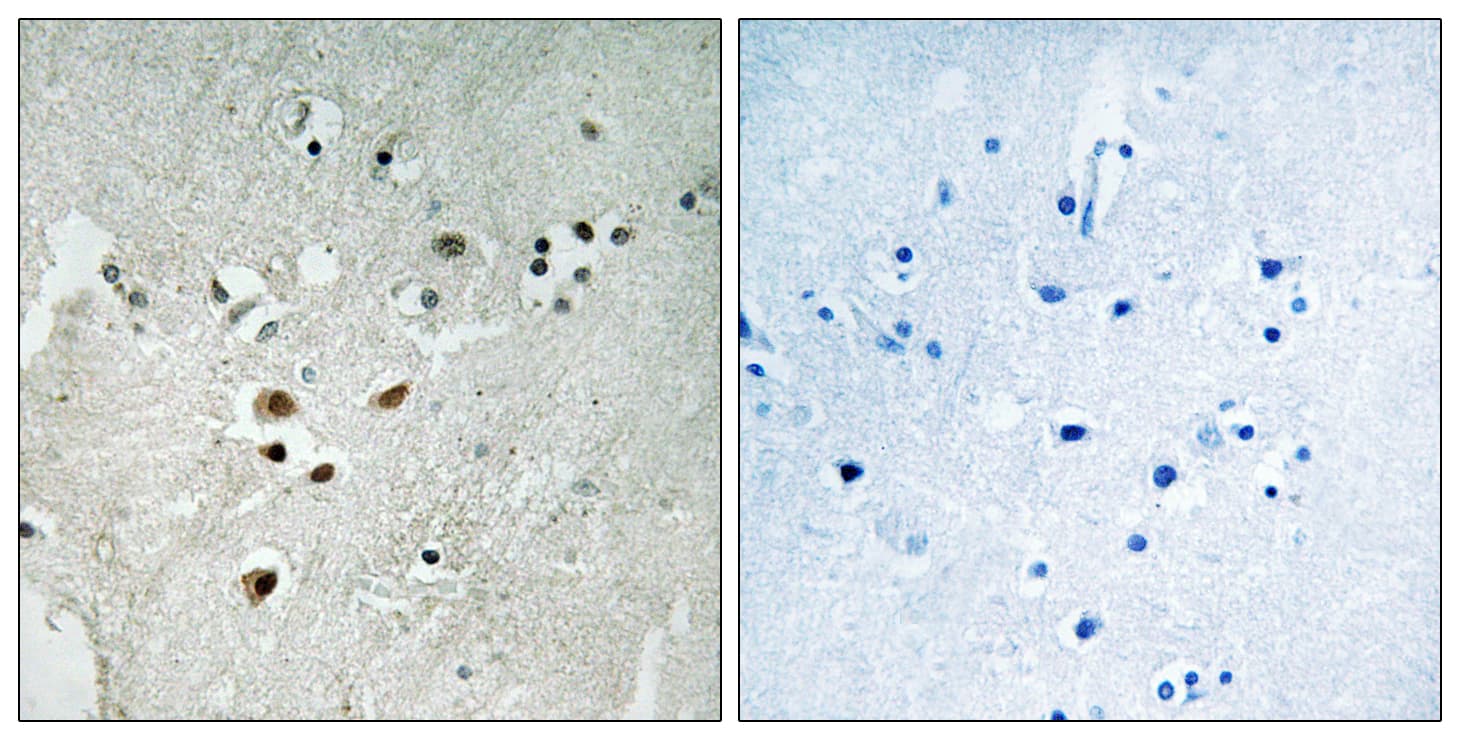 ELK3 / NET Antibody (phospho-Ser357)