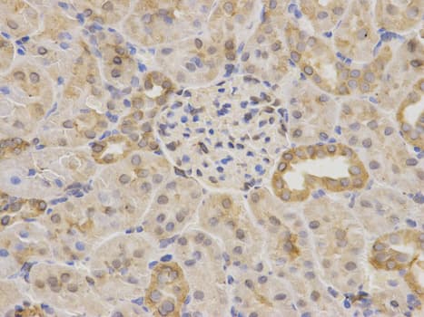IHC-plus™ Polyclonal Rabbit anti-Human MAOA / Monoamine Oxidase Antibody (IHC, WB)