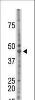 Polyclonal Rabbit anti-Human CSNK2A1 Antibody (aa240-269, IHC, WB)