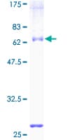 Human UBP43 / USP18 Protein (Recombinant GST)