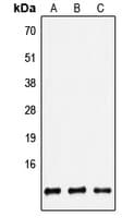 IHC-plus™ Polyclonal Rabbit anti-Human DEFB4A / BD-2 Antibody (Internal, IHC, WB)