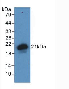 HFE2 / Hemojuvelin Antibody