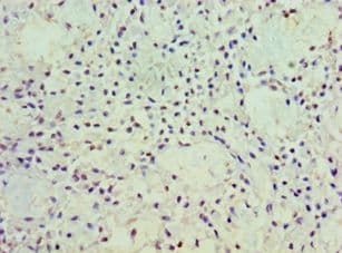 POSTN / Periostin Antibody (aa557-836)