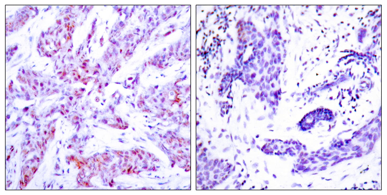 ATF4 Antibody (aa212-261)