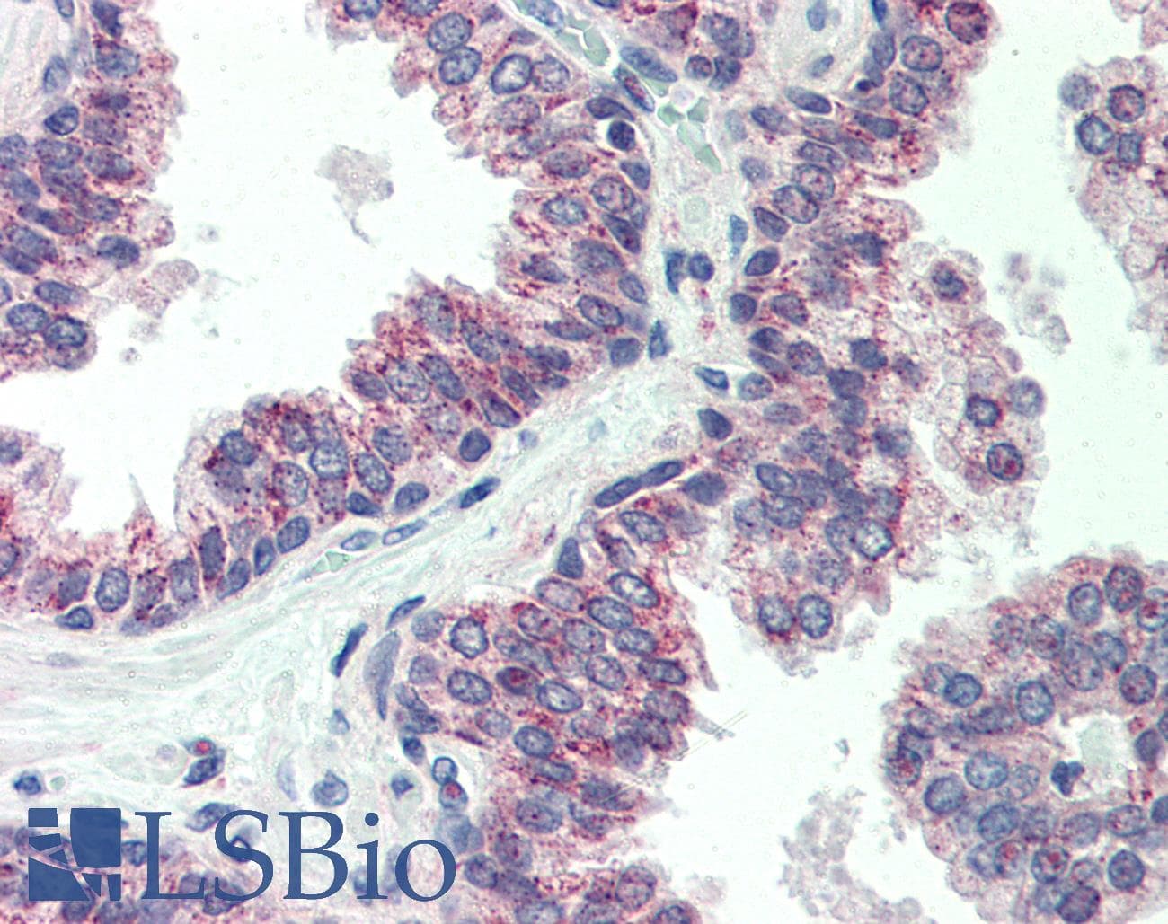 IHC-plus™ Polyclonal Rabbit anti-Human CBLN1 / Cerebellin 1 Antibody (IHC, WB)
