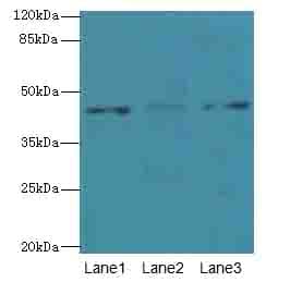 DCC1 / DSCC1 Antibody