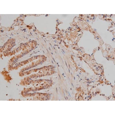 Polyclonal Rabbit anti-Human SP1 Antibody (phospho-Thr739, IHC, IF, WB)