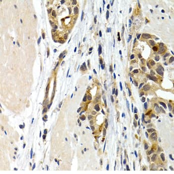 IL9 Antibody