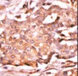 Polyclonal Rabbit anti-Human RAD9A / RAD9 Antibody (phospho-Ser272, IHC, WB)