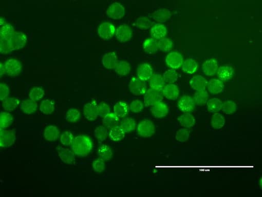 ERBB2 / HER2 Antibody (aa676-1255, clone UMAB33)