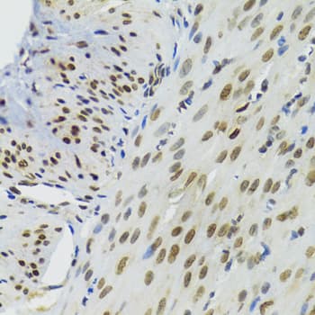 BAZ1B / WSTF Antibody