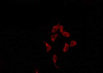 SP32 / ACRBP Antibody