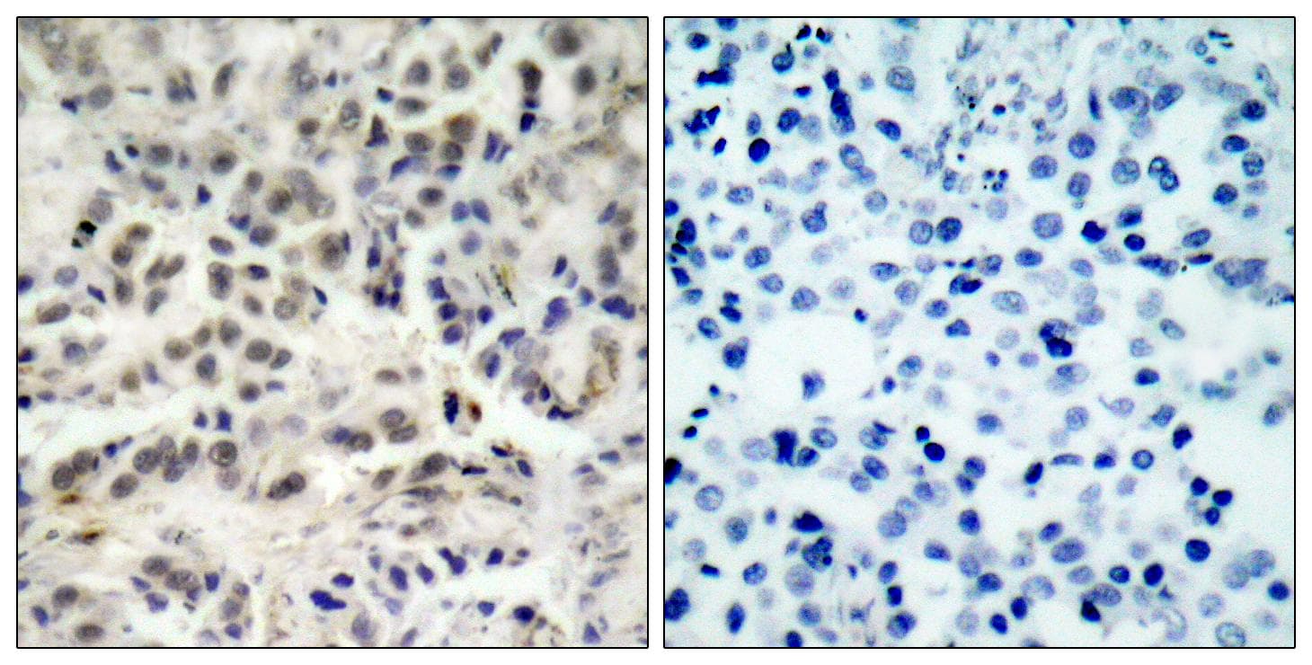 CDKN1B / p27 Kip1 Antibody (p10)