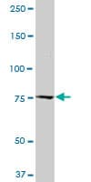 CAST / Calpastatin Antibody (clone 2C5)