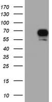 RPS6KB1 / P70S6K / S6K Antibody (clone OTI6B2)