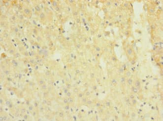 TRPM7 Antibody