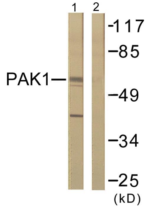 PAK1 Antibody (p212)