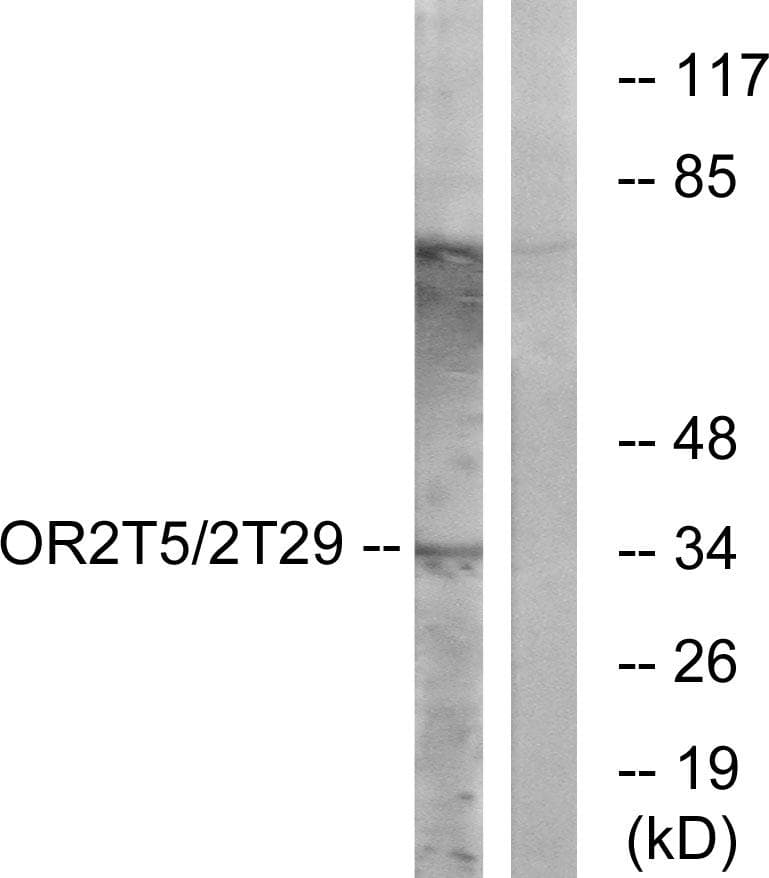 OR2T5+29 Antibody