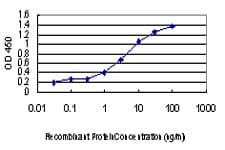 IHC-plus™ Monoclonal Mouse anti-Human CDKL1 Antibody (clone 5B11, IHC, IF, WB)