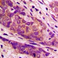 Polyclonal Rabbit anti-Human CYP7B1 Antibody (Internal, IHC, WB)