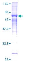 Human KIAA1840 / SPG11 Protein (Recombinant GST)