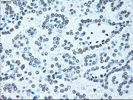 BRAF / B-Raf Antibody (clone OTI4C5)