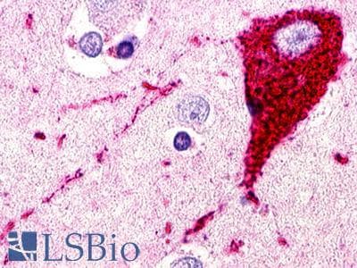 PathPlus™ Polyclonal Rabbit anti-Human GPR173 / SREB3 Antibody (N-Terminus, IHC)