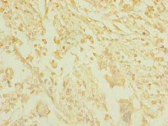 T1R3 / TAS1R3 Antibody
