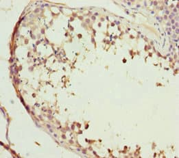 Polyclonal Rabbit anti-Human ABCB8 Antibody (IHC)