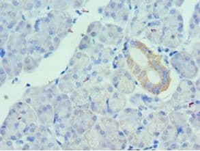 UTS2 / Urotensin II Antibody (aa35-124)
