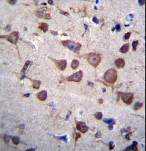 GPI3 / PIGA Antibody (aa455-484)