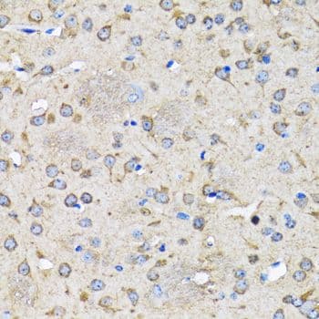 MAP1LC3B / LC3B Antibody