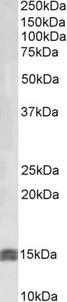 IHC-plus™ IGF1 Antibody (aa100-109)