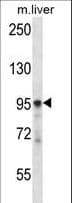 Polyclonal Rabbit anti-Human PLCD3 Antibody (aa60-89, WB)
