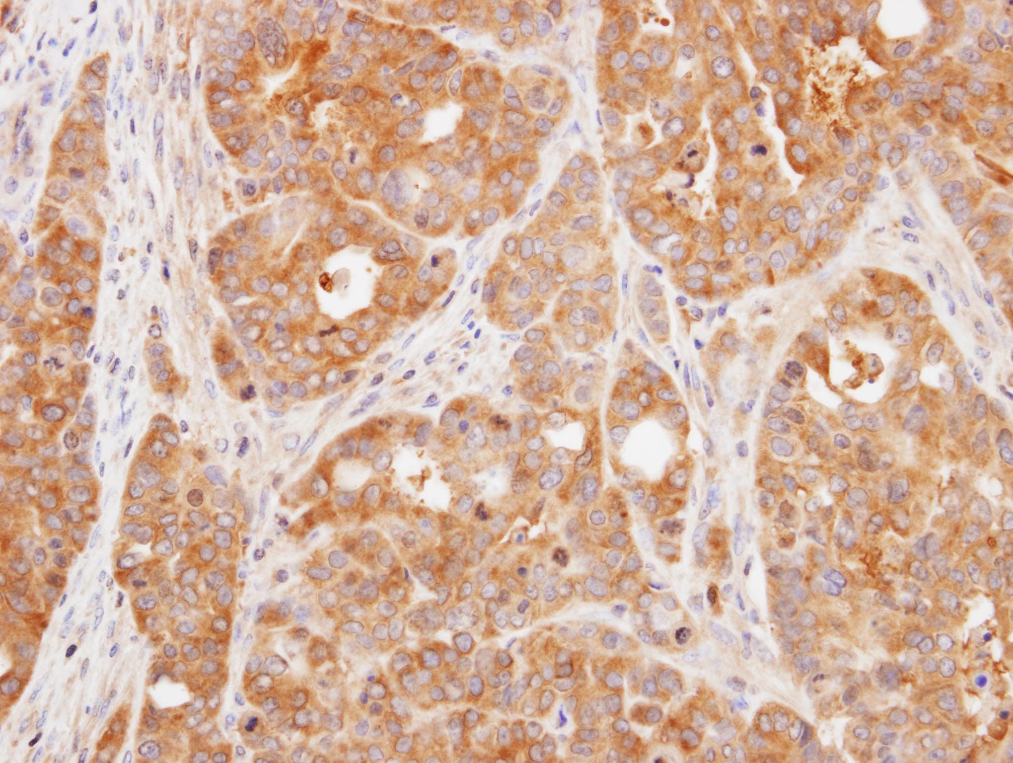 DUSP3 / VHR Antibody (aa1-185)