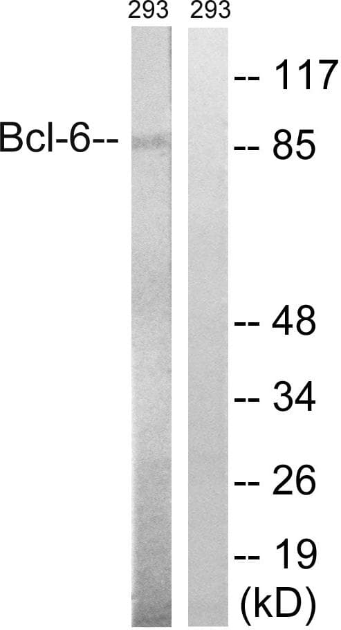Polyclonal Rabbit anti-Human BCL6 Antibody (p333, WB)
