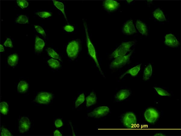 IHC-plus™ TCP1 Antibody (clone 2B2-D6)