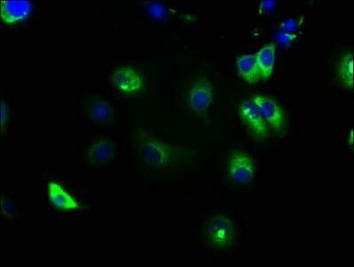Polyclonal Rabbit anti-Human NOTCH2 Antibody (IHC)