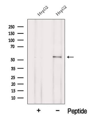 Polyclonal Rabbit anti-Human POMGNT1 Antibody (IF, WB)