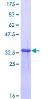 Human MT1A / Metallothionein 1A Protein (Recombinant GST)