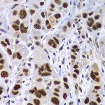 Polyclonal Rabbit anti-Human SF3B2 Antibody (IHC, IF, WB)